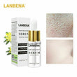 Pore Shrinkage Liquid Remove Blackhead Whitehead Acne Deep Cleansing Whitening.