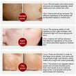 Pore Shrinkage Liquid Remove Blackhead Whitehead Acne Deep Cleansing Whitening.