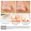 Pore Shrinkage Liquid Remove Blackhead Whitehead Acne Deep Cleansing Whitening.