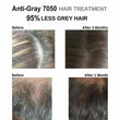 500 Anti Gray Hair Saw Palmetto Catalase Horsetail Max Strength Natural