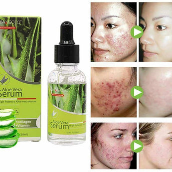 Natural Acne Skin Repair Soothing Liquid High Potency Aloe Vera Facial Serum