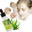 Natural Acne Skin Repair Soothing Liquid High Potency Aloe Vera Facial Serum