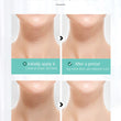 Roller Neck Cream Elastic V-shaped Anti-wrinkle Reduce Fine Lines Lift Firming