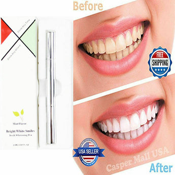 20 Pcs Tooth Bleaching Whitener Oral Gel System Mint Flavor Teeth Whitening Pen