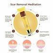 LanBeNa Pimple Scar Acne Mark Spots Removal Treatment Gel Ointment Blemish Cream