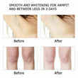 3 Days Body Skin Whitening Cream for Sensitive Area Armpit Leg Knee Private Part.