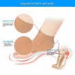 2 Pairs Vented Heel Socks Dry Pain Relief Foot Care Moisturizing Silicone Gel