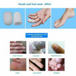 2 Pieces Gel Tube for Finger And Toe Protects Corns Ingrown Nails Blisters