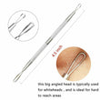 Acne Pimple Blackhead Blemish Skin Remover Extract Stainless Steel Face Care Kit