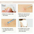 7pcs Blackhead Acne Comedone Pimple Blemish Extractor Remover Tool Kit Set