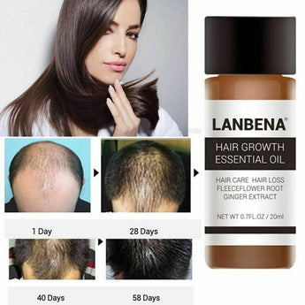 Lanbena Powerful Natural Hair Loss Treatment Fast Hair Growth Essential Oil 20ml