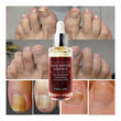 Ginger Antibacterial Fungal Nail Treatment Nail Repair Essential Oil Serum 12ml