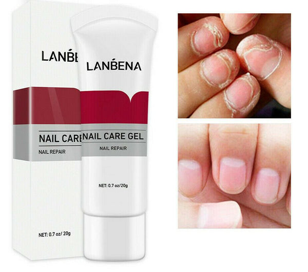 Lanbena Fungal Nail Treatment Onychomycosis Remove Nail Repair Gel Serum 20g