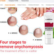 Lanbena Fungal Nail Treatment Onychomycosis Remove Nail Repair Gel Serum 20g
