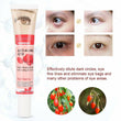 Anti Aging Q10 Goji Berry Extract Medlar Firming Dark Circle Fading Eye Cream