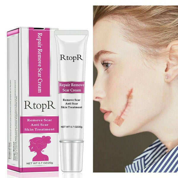 RtopR Acne Spots Anti Scar Stretch Marks Remover Skin Repair Face Cream 20g