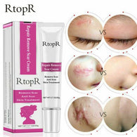 RtopR Acne Spots Anti Scar Stretch Marks Remover Skin Repair Face Cream 20g