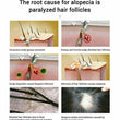 2 Pack Powerful Natural Hair Loss Treatment Fast Hair Growth Essential Oil 20ml