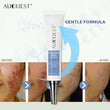 Acne Treatment Face Cream Acne Removal Gel Remove Pimple Skin Repair Cream