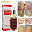 2 Pack Ginger Antibacterial Fungal Nail Treatment Nail Repair Oil Serum 12ml