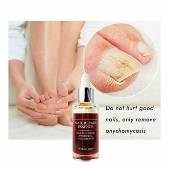 2 Pack Ginger Antibacterial Fungal Nail Treatment Nail Repair Oil Serum 12ml