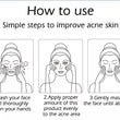 2 Pack Acne Removal Nicotinamide Cream Aloe Vera Oil Control Shrink Pores