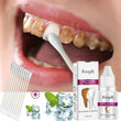 Teeth Whitening Pen Tooth Bleaching Whitener Oral Gel System
